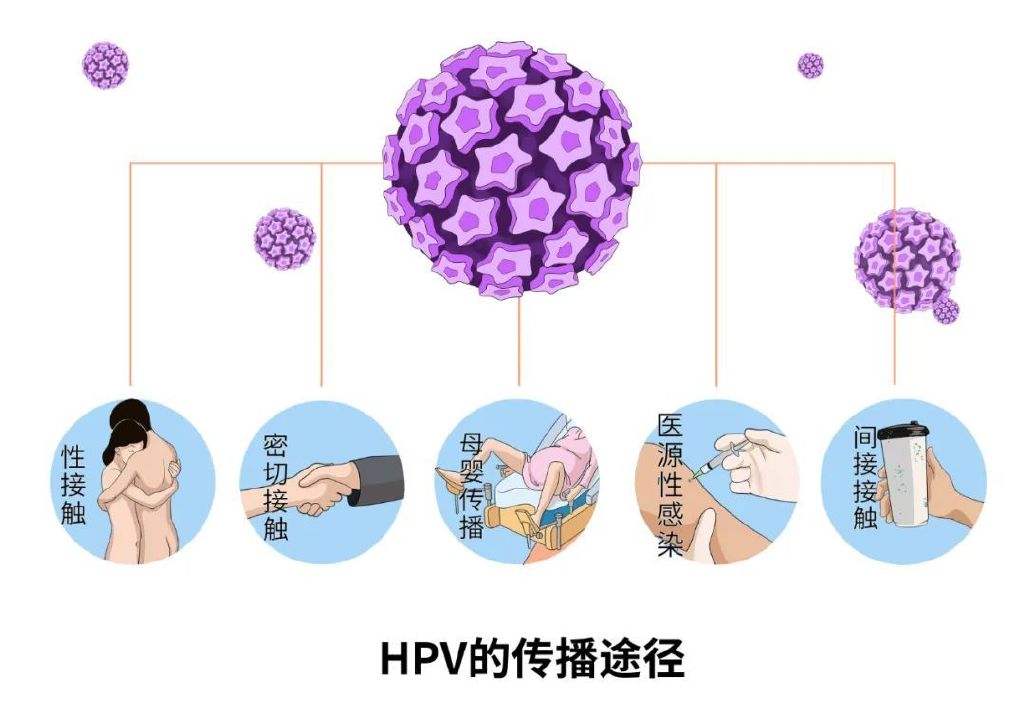 ҸȾ˸ΣHPV,ΣHPV𣿿ƪ¾дˣ